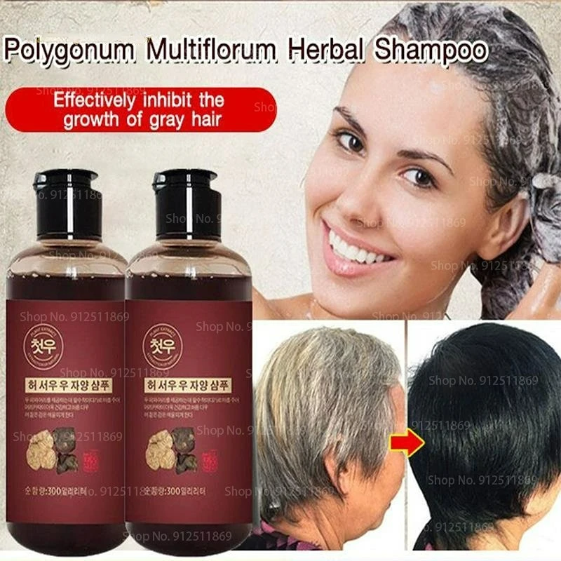 300ml Polygonum Multiflorum Beyaz Siyah Şampuan Bitkisel Polygonum Şampuan Etkili Gri Saç Çıkarıcı Anti Beyaz Saç Tedavisi